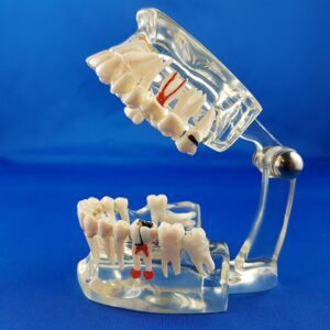 Vista laterale sinistra modello didattico dimostrativo trasparente di bocca umana patologica dialogo medico paziente varie patologie riabilitazioni