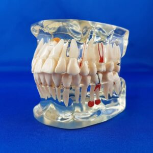 Vista frontale modello didattico dimostrativo trasparente di bocca umana chiusa patologica dialogo medico paziente varie patologie riabilitazioni