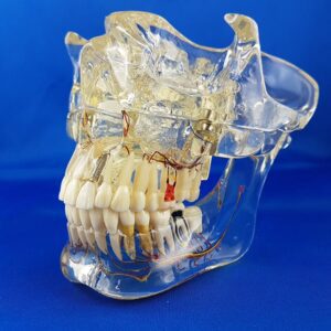 Modello dimostrativo di mandibola, mascella e seni mascellari per varie patologie, vista laterale chiusa
