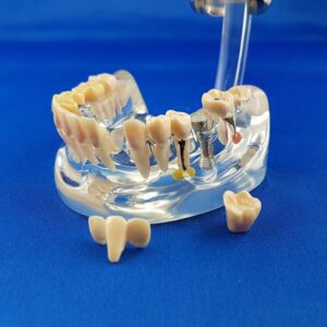 Bocca umana trasparente per esercitazione didattica patologica, vista laterale con denti smontati