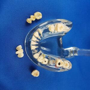 Bocca umana trasparente per esercitazione didattica patologica, vista dall'alto con denti smontati