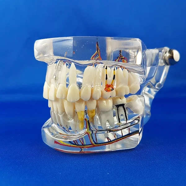 vista completa laterale destra bocca umana trasparente patologica per esercitazione