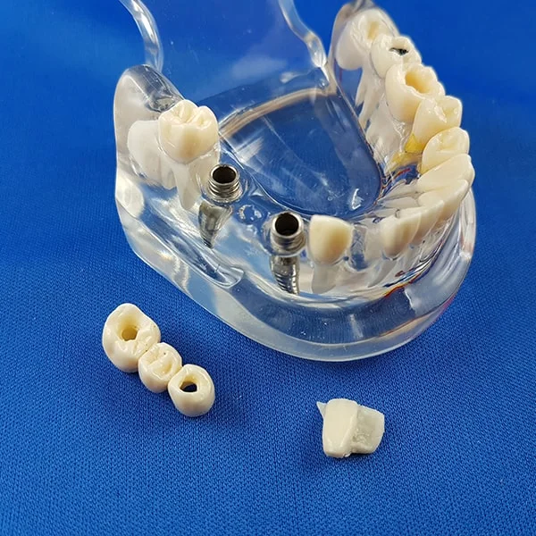 vista palato inferiore bocca umana trasparente patologica