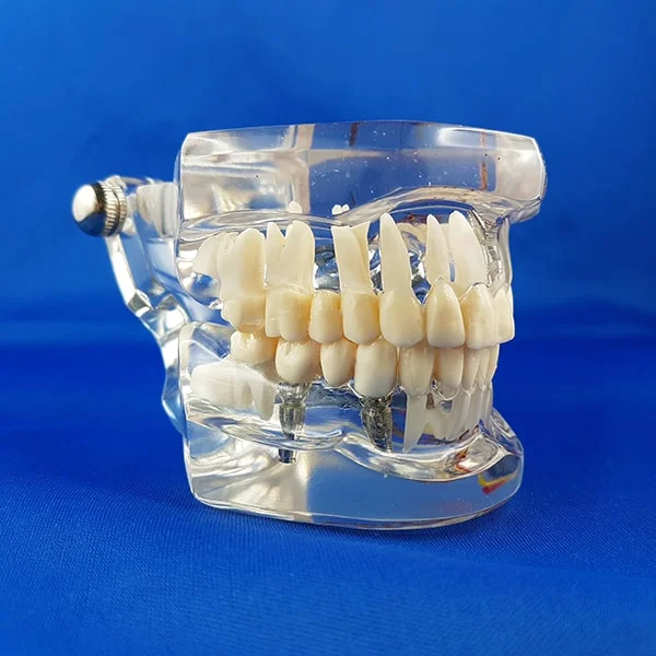 vista completa bocca umana trasparente patologica per esercitazione