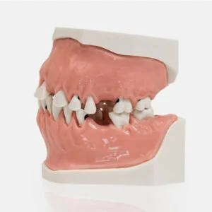 Modello bocca umana vista laterale - DENTALSTORE Modello bocca umana vista laterale - DENTALSTORE