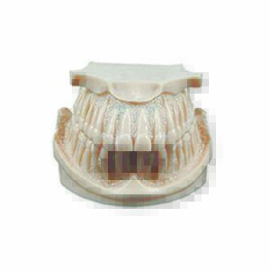 Bocca con osso scalpellato