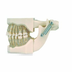 Bocca standard su occlusore con gengive trasparenti