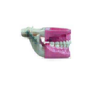 Bocca con occlusore e denti sfilabili