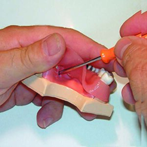 Modello esercitazione avulsione