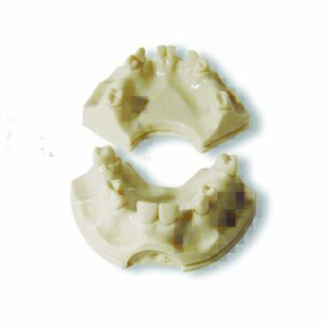 Base di protesi a supporto implantare