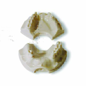 Protesi supporto implantare