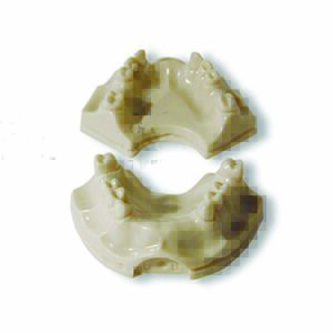 Protesi con supporto implantare