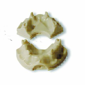 Modello protesi con supporto implantare