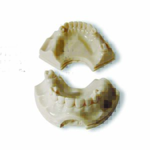 Protesi di base con supporto implantare