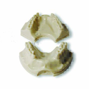 Modello con supporto implantare