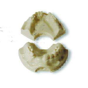 Protesi supporto implantare