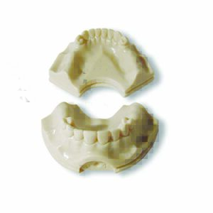 Protesi a supporto implantare