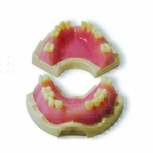 Base di protesi a supporto implantare con gengiva rosa