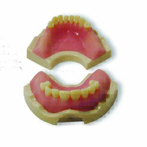 Base di protesi a supporto implantare con gengiva rosa asportabile