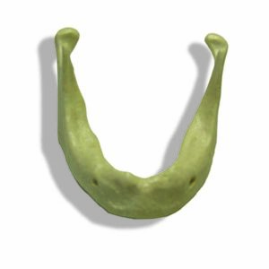 Modello mandibola con difetto osseo