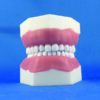 Modello pedodontico a 24 denti con estrazione denti a vite