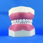 Modello completo superiore e inferiore a 24 denti per esercitazioni pedodontiche con gengive in silicone iperplastico ed estrazione dei denti a vite, attacco a manichino