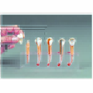 Denti ingranditi dimostrativi