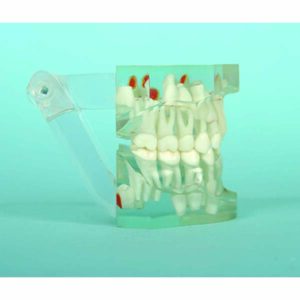 Bocca a sette anni di età