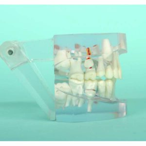 Bocca a dieci anni di età