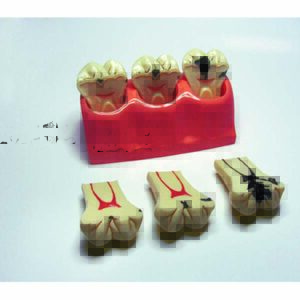 Denti semplificati dimostrativi