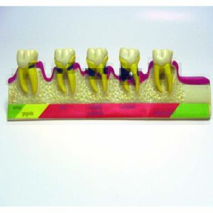 Dente dimostrativo varie fasi