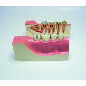 Bocca emisezionata dimostrativa