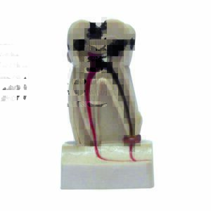 Dente ingrandito