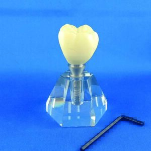 Modello trasparente dimostrativo con impianto ingrandito 5 volte con moncone svitabile, corona e base trasparente.