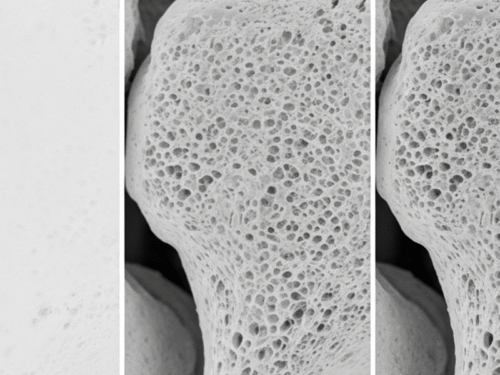 Classificazioni e predicibilità restauro implantare